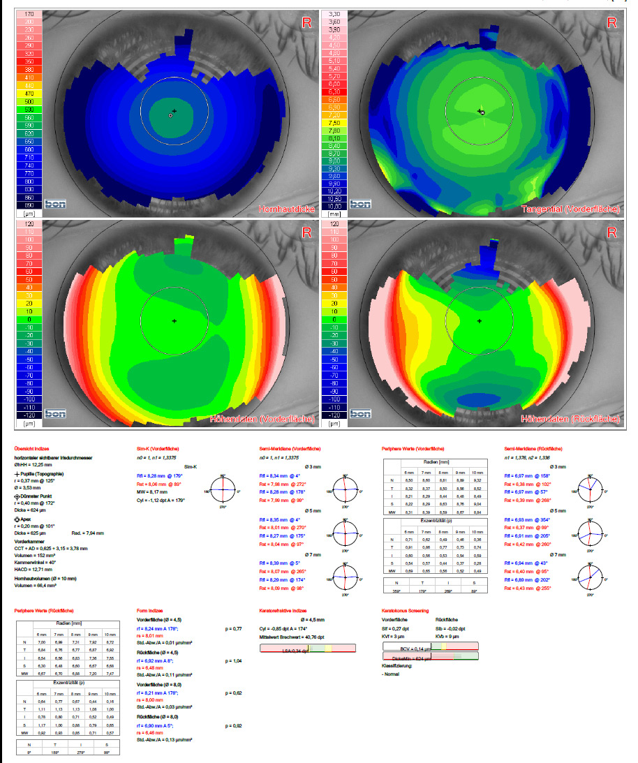 topographie-handzel-2